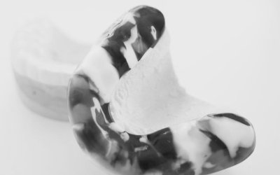 Smileproff: personaalne hambakaitse võib päästa nii sportlase tervise kui rahakoti